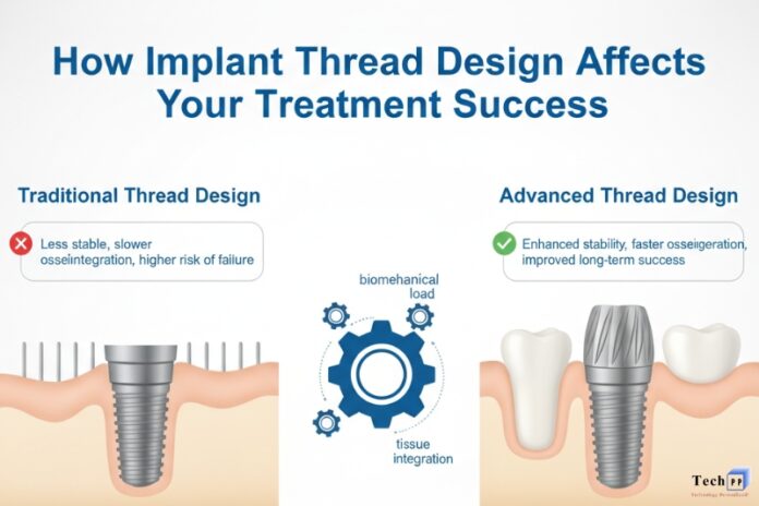 Implant Thread Design